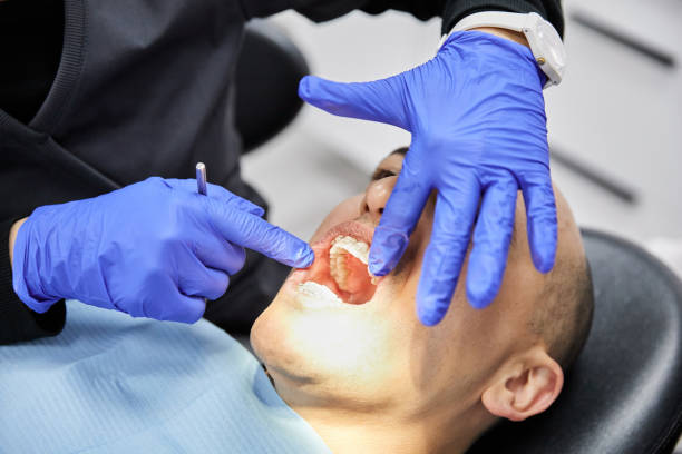 Best Emergency Root Canal Treatment in Monte Alto, TX